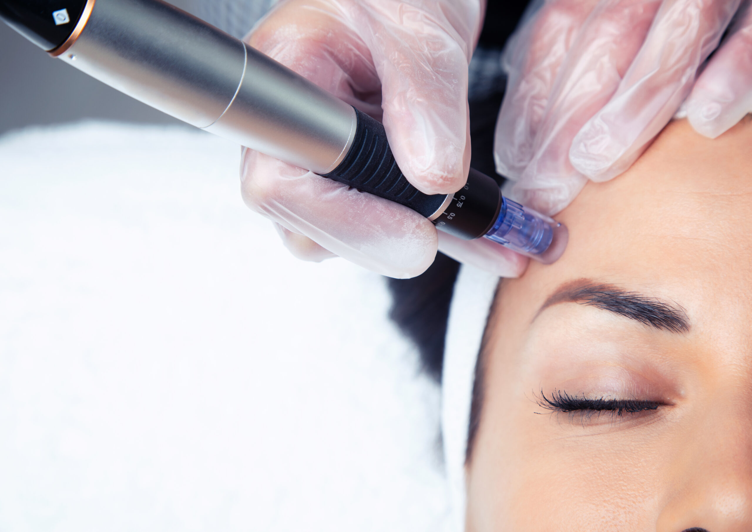 Cosmetologist making mesotherapy injection with dermapen on face